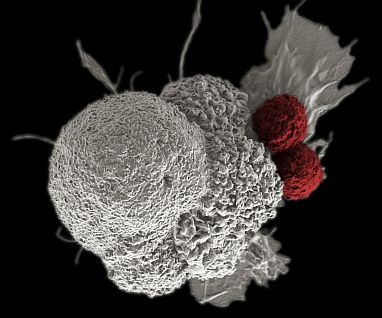 A cancer cell (white) being attacked by two T cells (red)
NIH